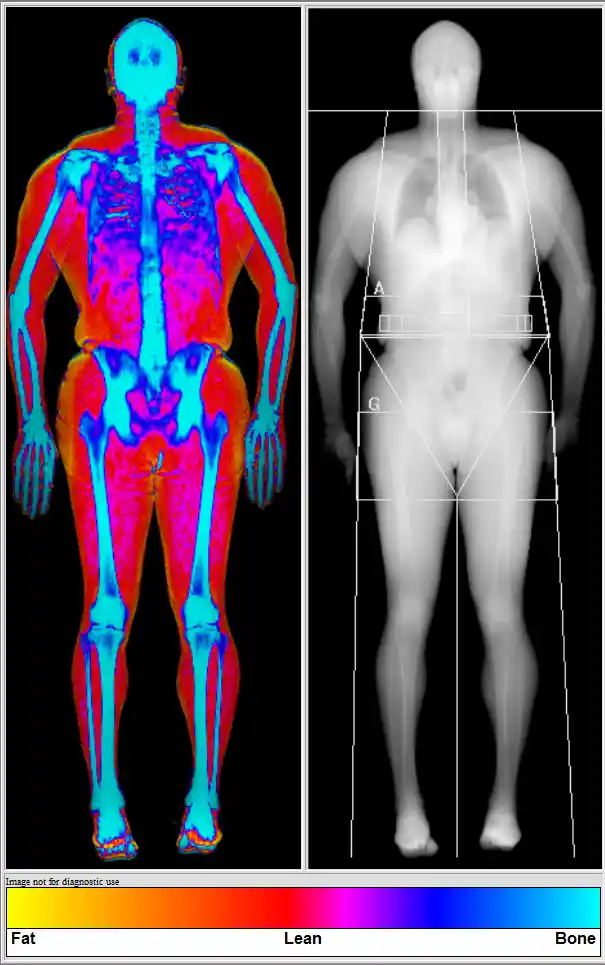 male dexa scan clients muscle map