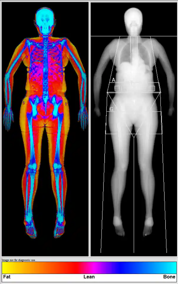 Female DEXA scan client muscle map